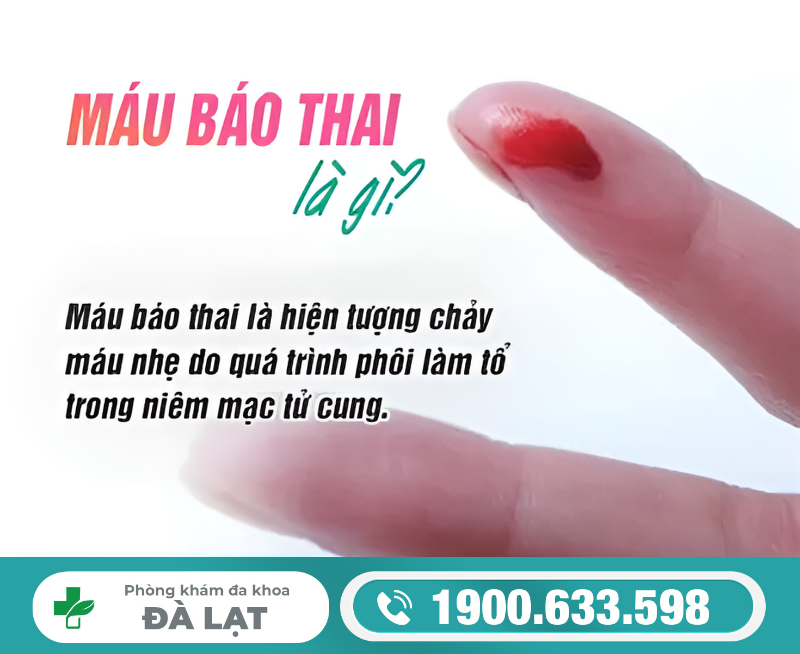 Hình ảnh minh họa